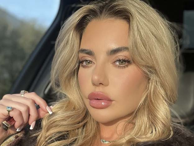 Megan Barton-Hanson 